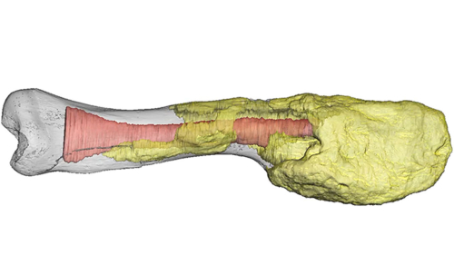 Doctors diagnose advanced cancer—in a dinosaur